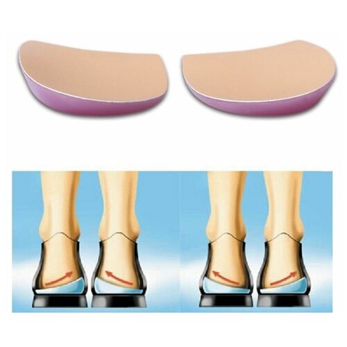 ���� ����������� �������� ����� ��� ����� ��� ���� ��� XO ������� (����), ������ �� 387 ���